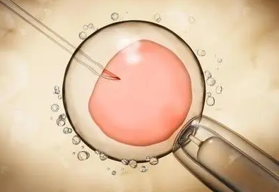 私人拉拉借卵代怀助孕咨询